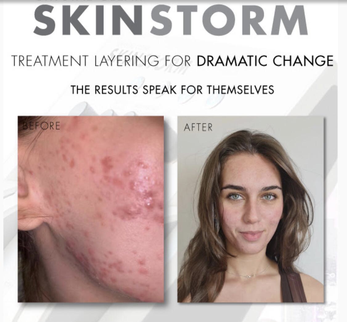 skinstorm banner